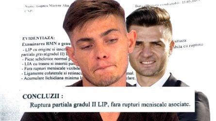 Permalink to Bratu și durerea în ligament